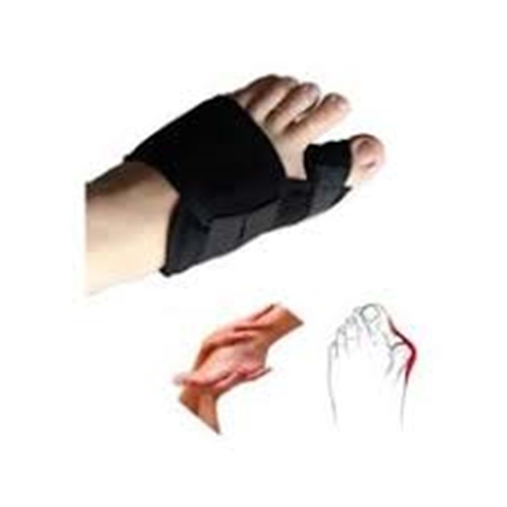 MT HALLUX VALGUS GECE ATELİ SOL